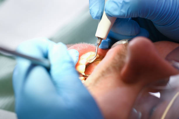Best Walk-In Emergency Dentist in Pikesville, MD