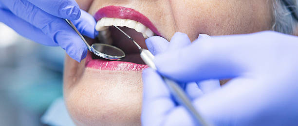 Best Emergency Broken Tooth Repair in Pikesville, MD